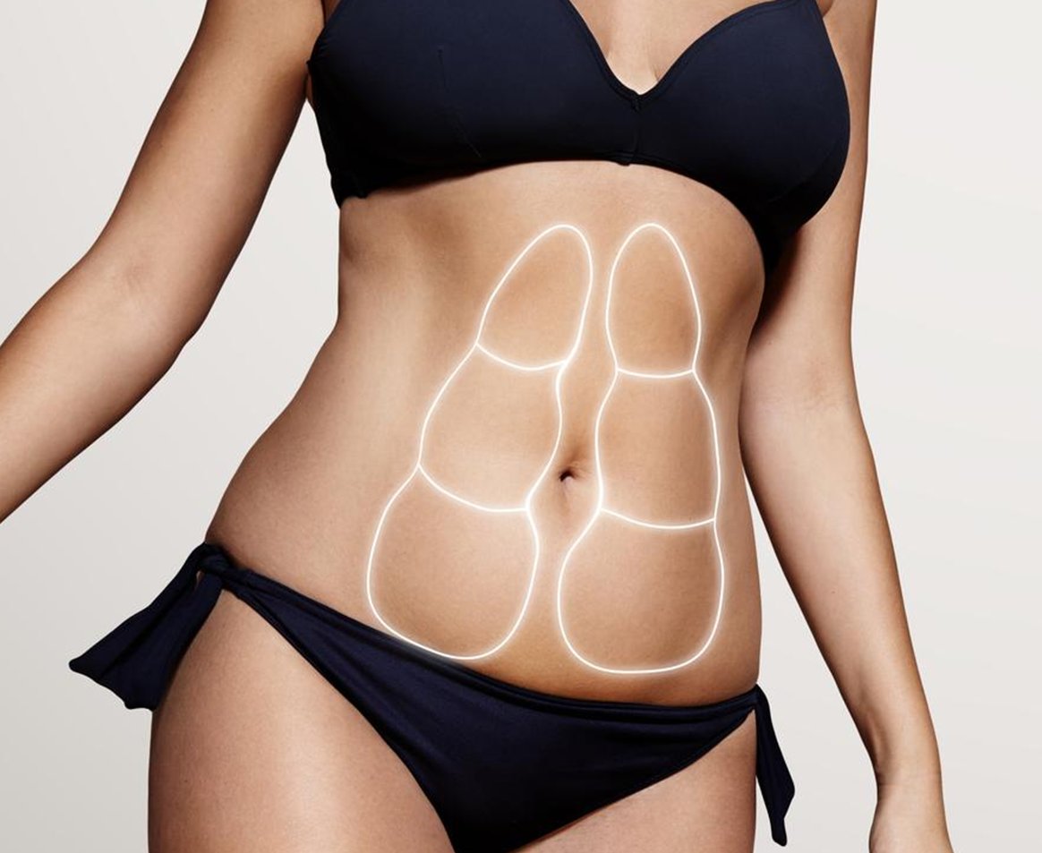 LIPOASPIRAÇÃO E LIPO HD